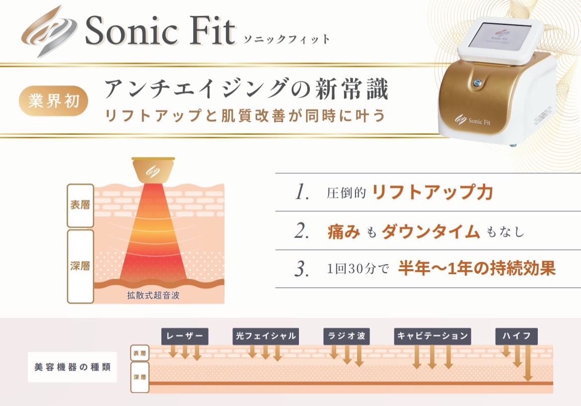 ソニックフィットの特徴